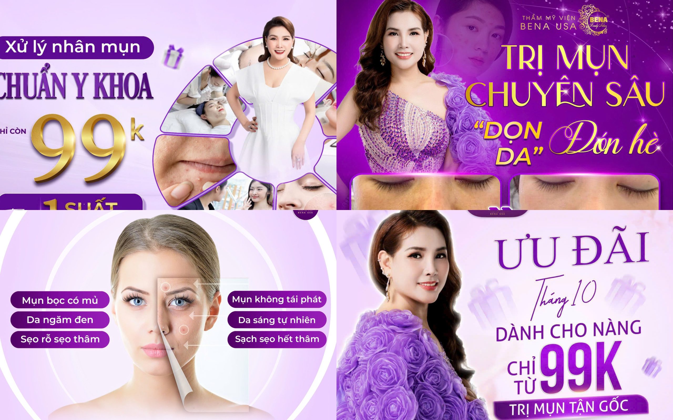 Trị mụn ở đâu hiệu quả? Thẩm mỹ viện Bena USA mang đến giải pháp chăm sóc da khoa học và hợp lý