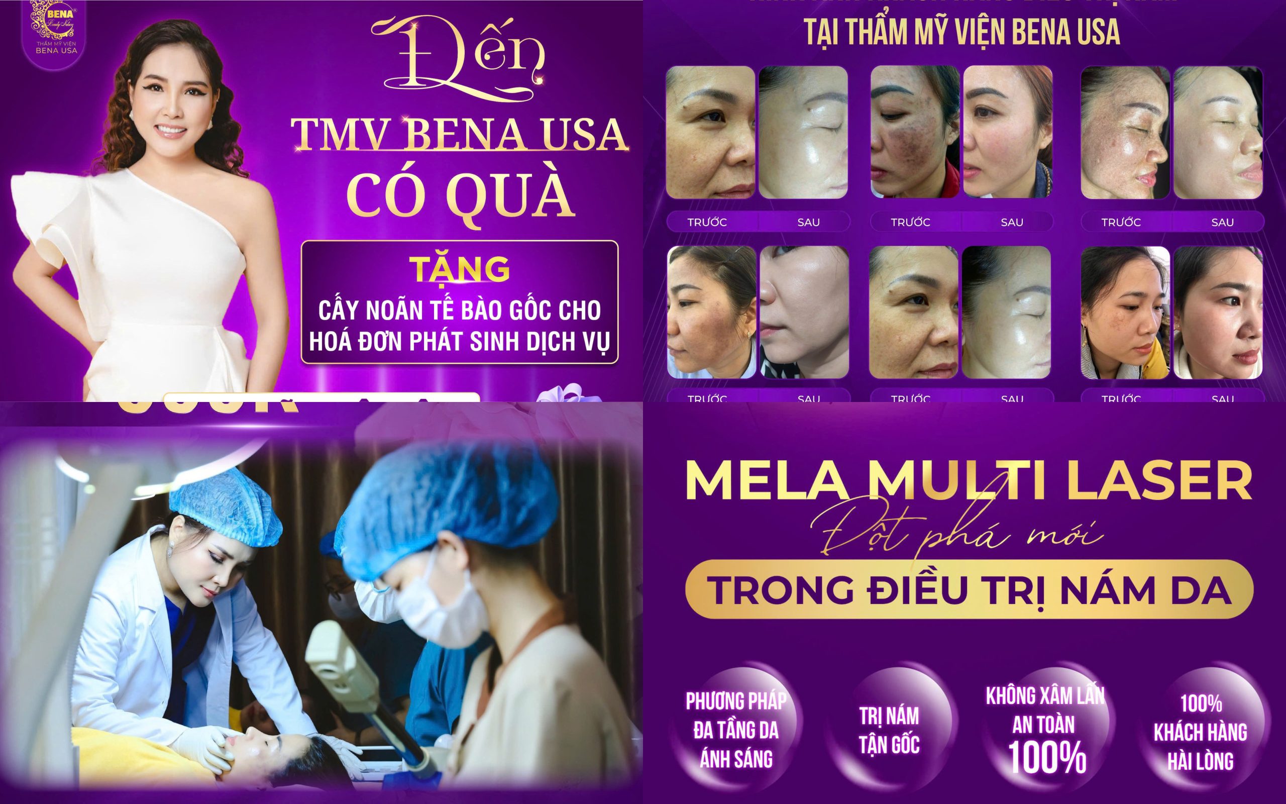 NÁM MẢNG LÂU NĂM PHỤC HỒI HOÀN TOÀN